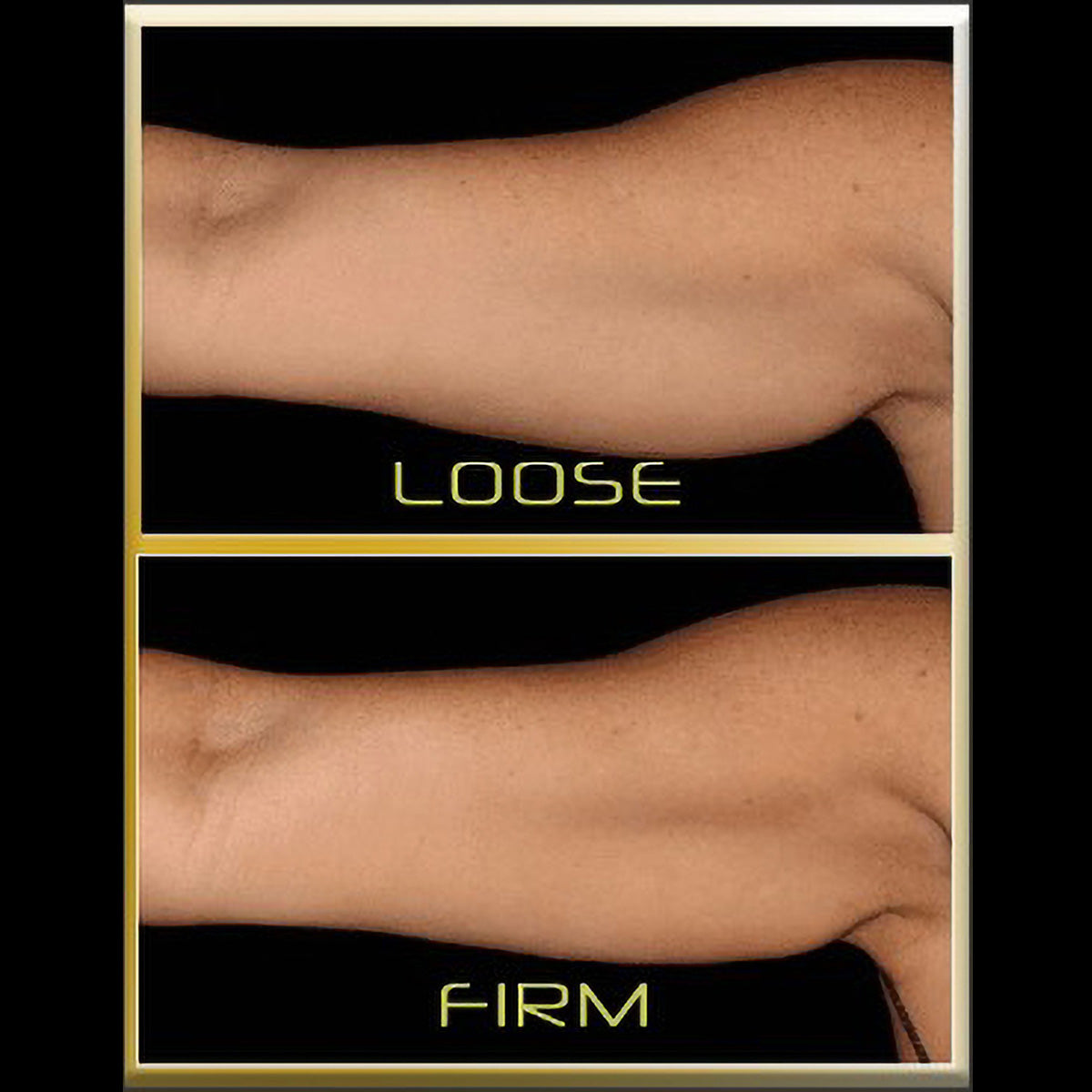 Underarm Toning Device
