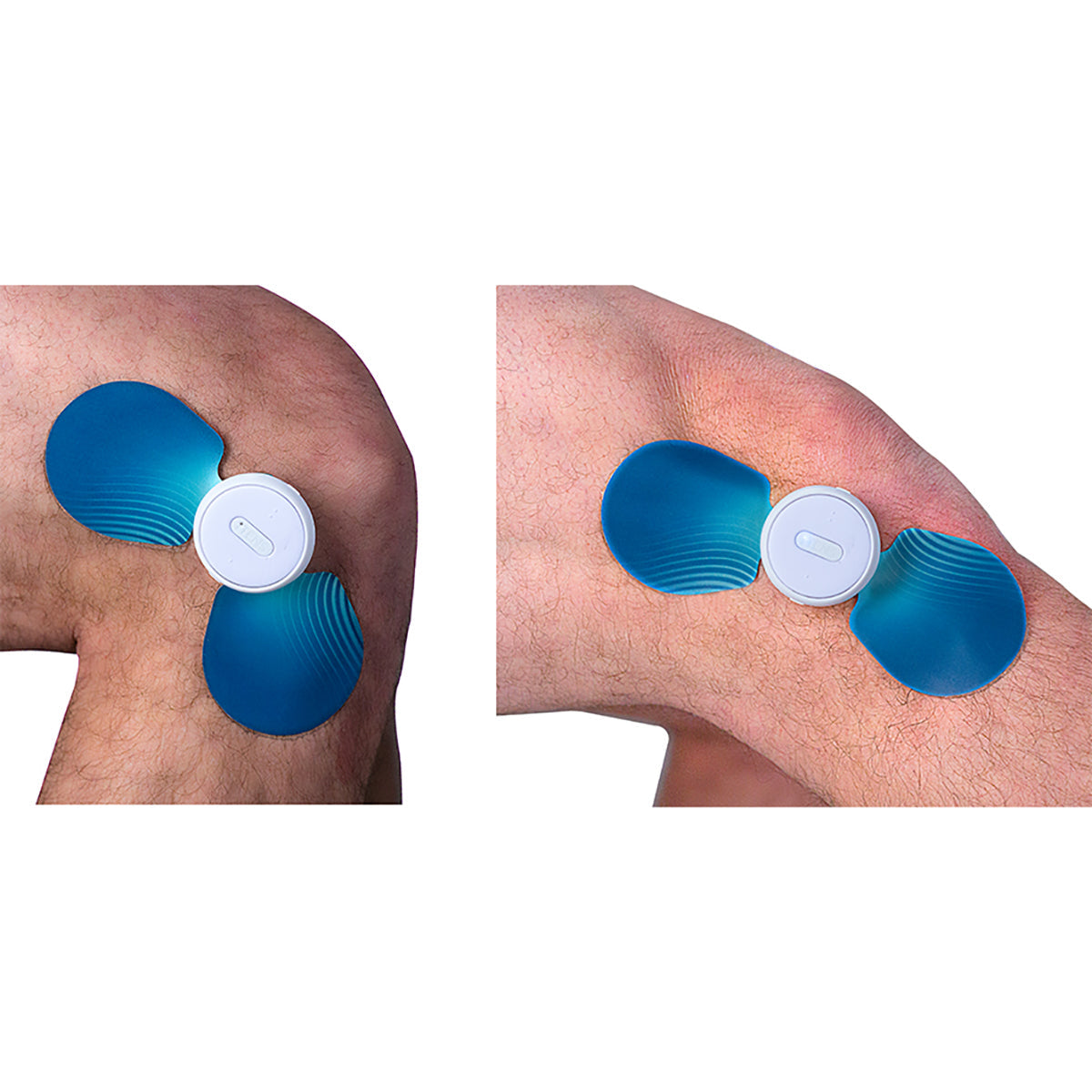 iTens Wearable Bluetooth Electrotherapy