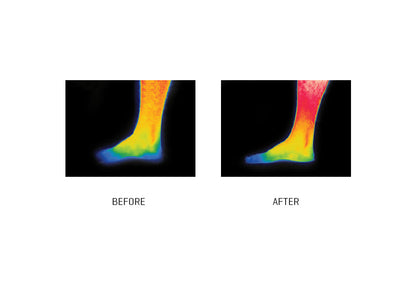 Infrared Pain Relief Socks (Set of 3)
