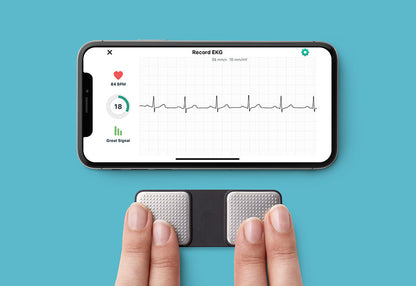 Portable Wireless EKG Monitor