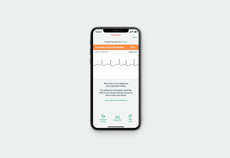 Portable ECG Monitor
