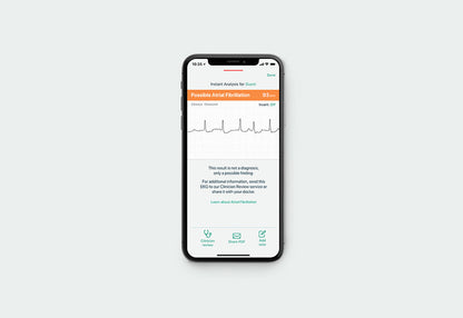 Portable ECG Monitor