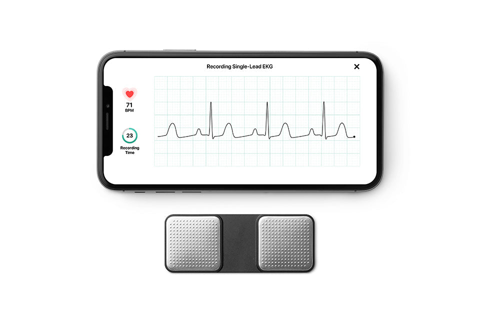 Portable Wireless EKG Monitor