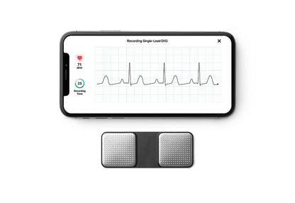 Portable Wireless EKG Monitor