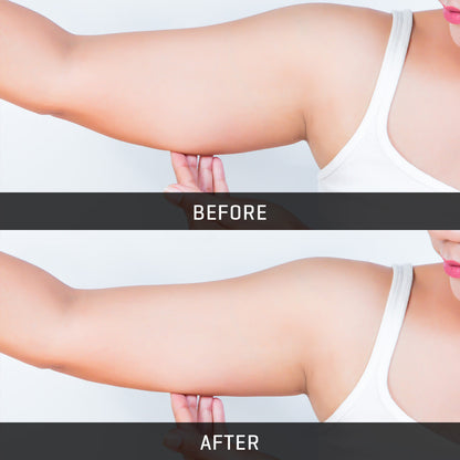 Underarm Toning Device