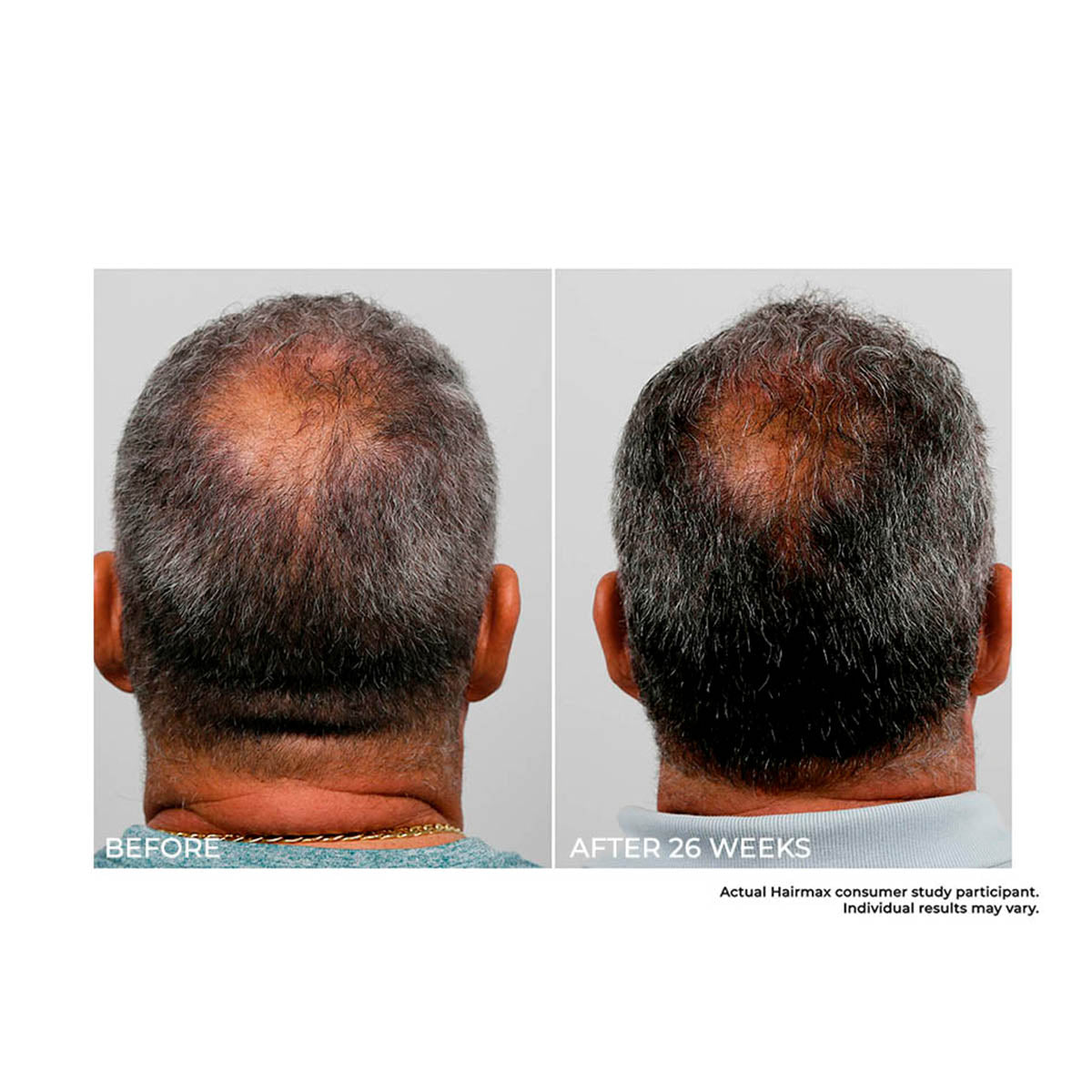 Cordless Scalp Therapy Comb