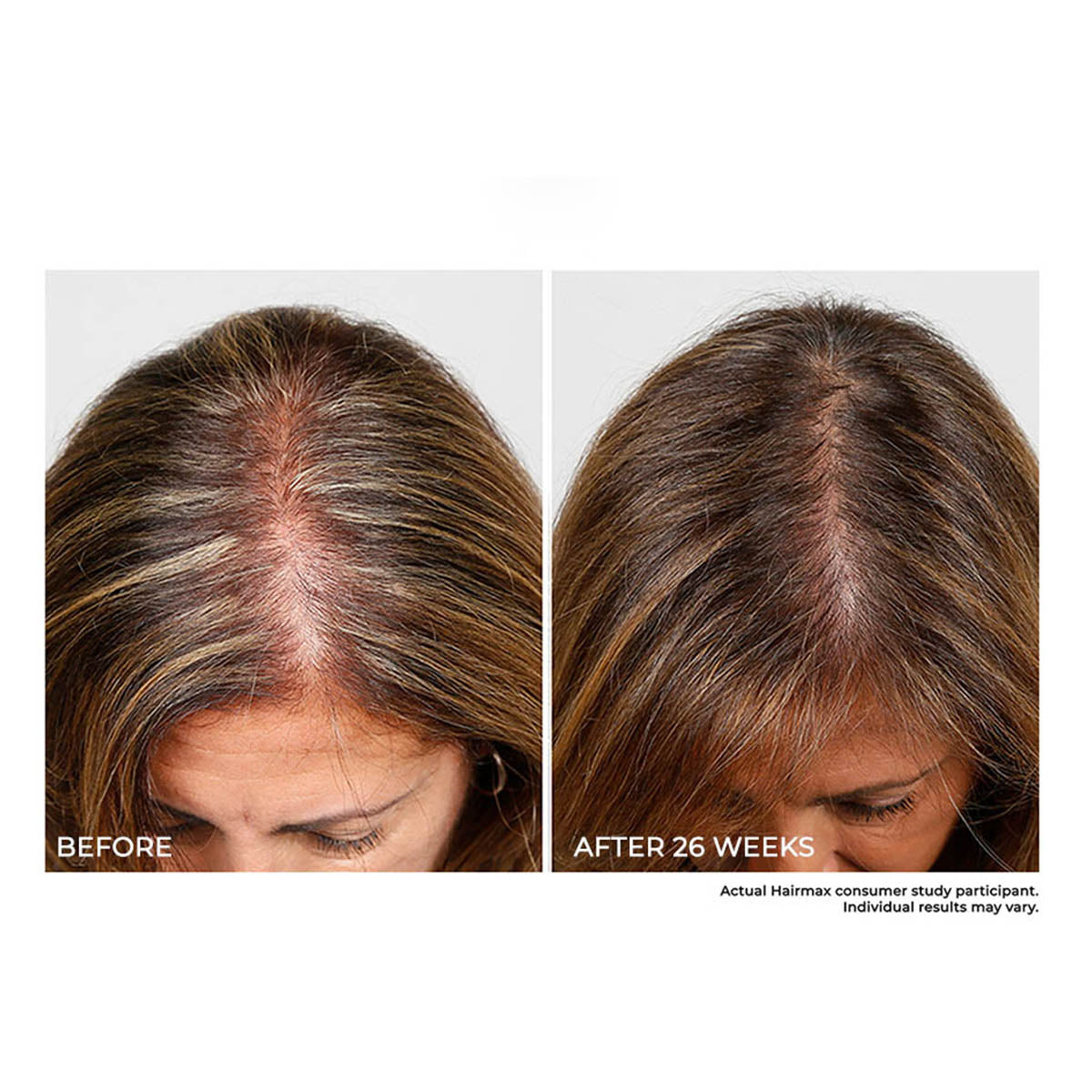 Cordless Scalp Therapy Comb