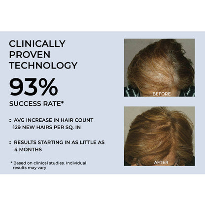 Cordless Scalp Therapy Comb