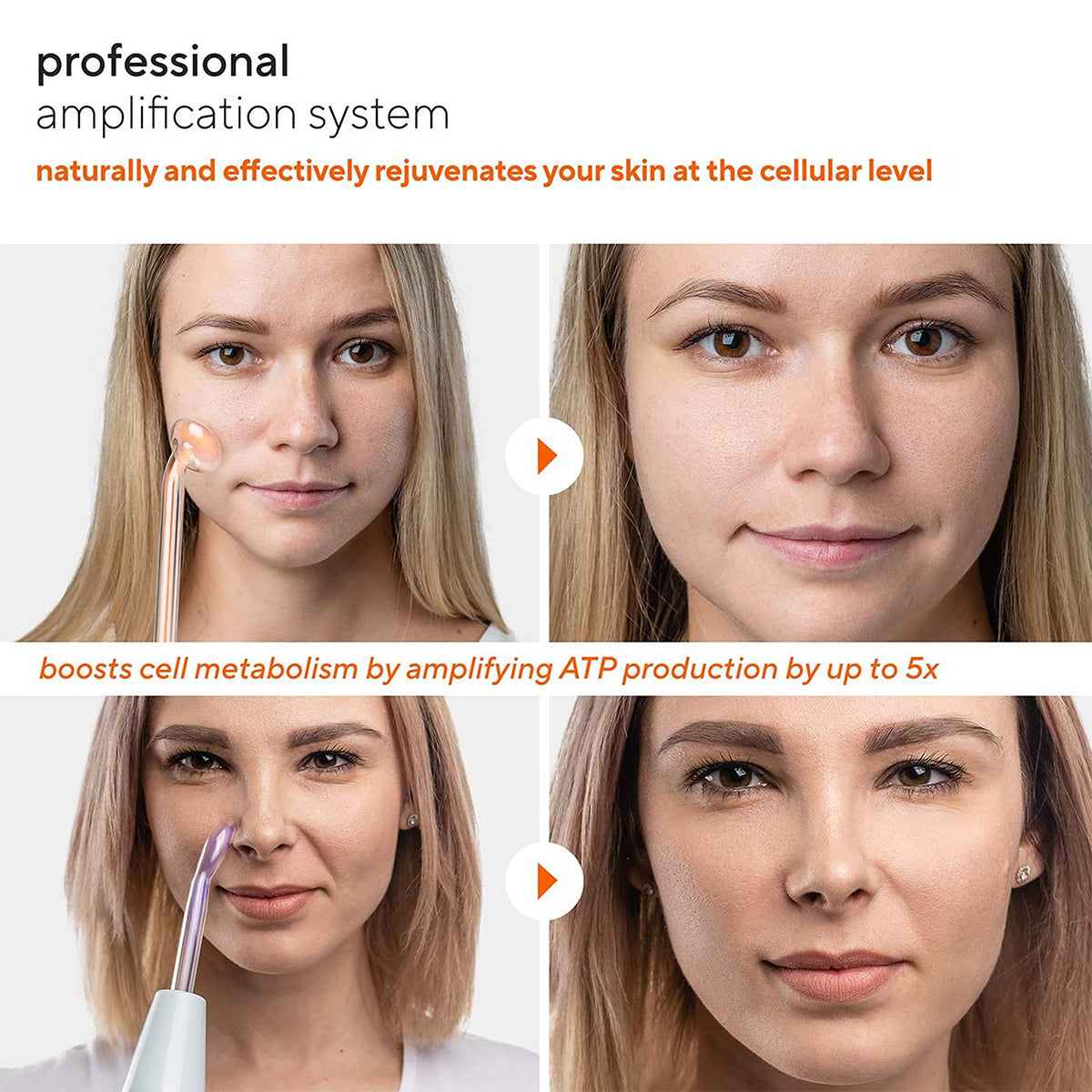 Professional Skin Renewal Device
