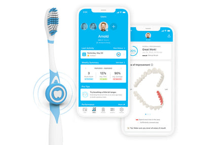 Toothbrushing Tracker
