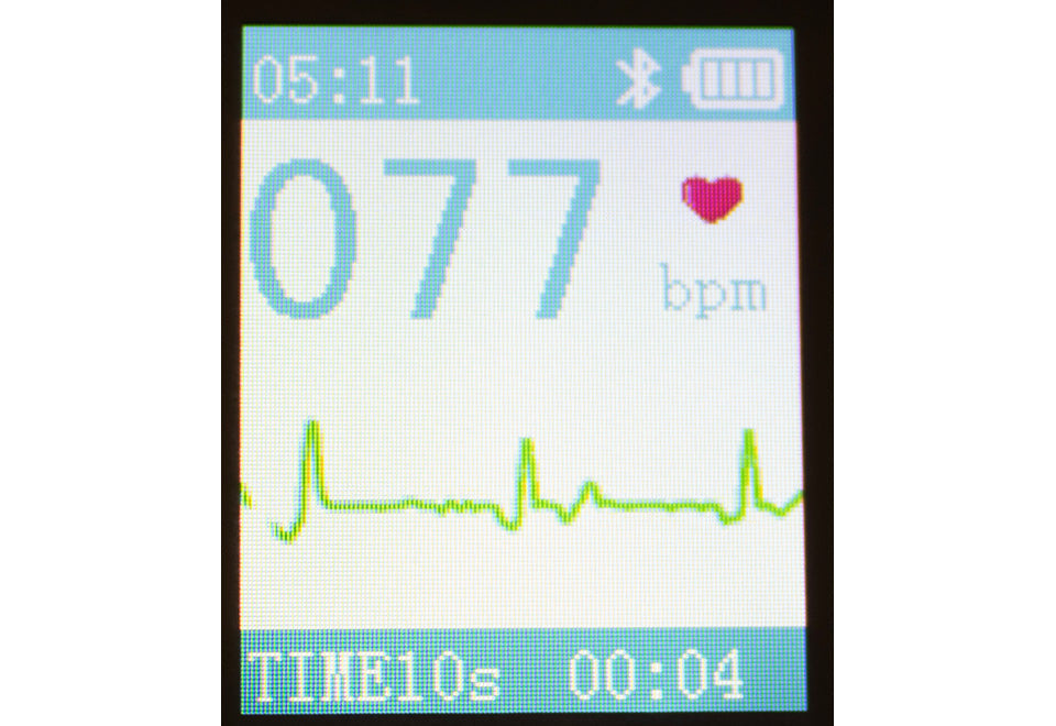 Portable Bluetooth EKG Monitor