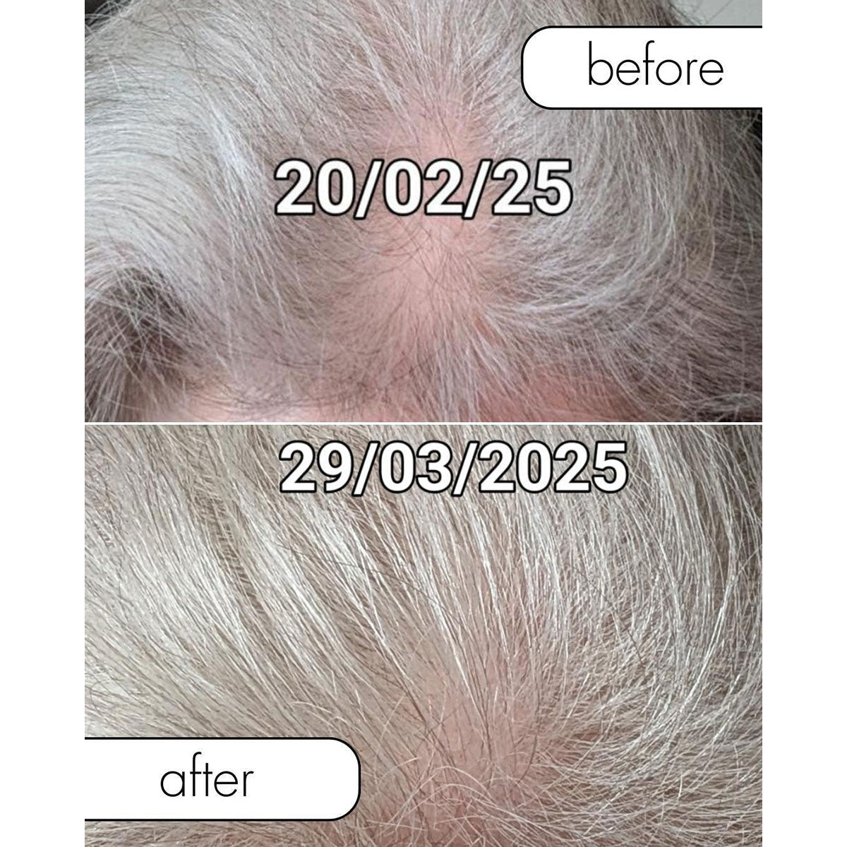 Wireless Scalp Light Brush