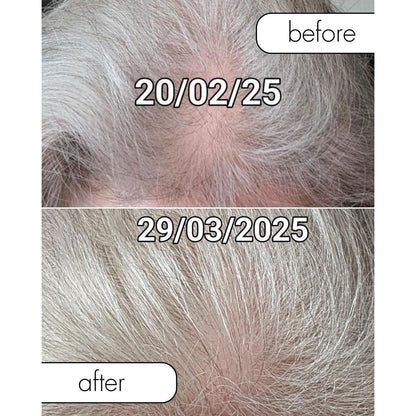 Wireless Scalp Light Brush