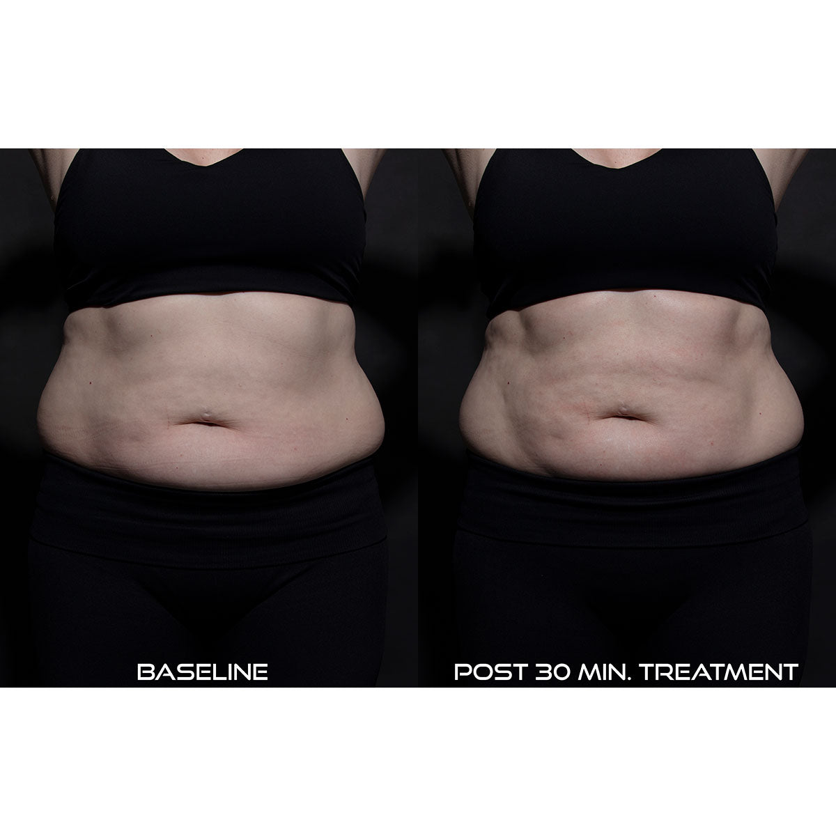 5-in-1 Body Sculpting Device