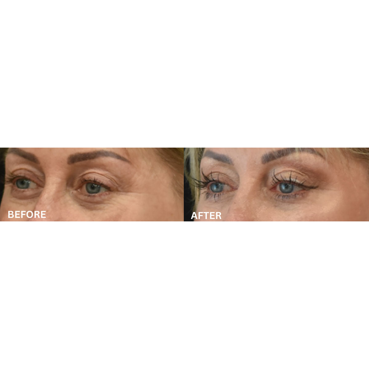 EMS & Heat Therapy Silicone Eye Mask