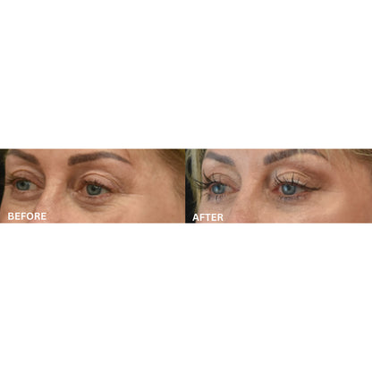 EMS & Heat Therapy Silicone Eye Mask